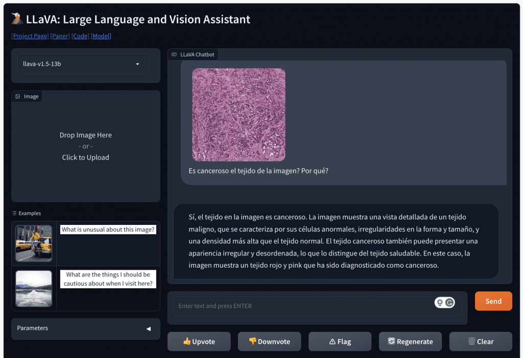 LLaVA explicando por qué un tejido es canceroso